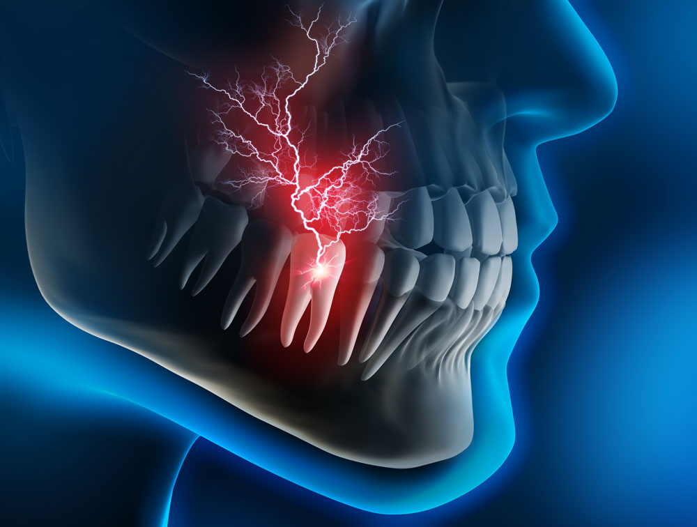 sinusitis-and-tooth-pain-mayo-clinic